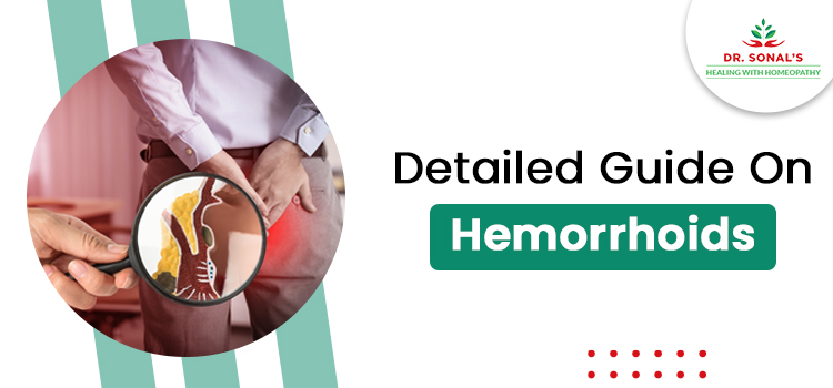 Detailed Guide On Hemorrhoids