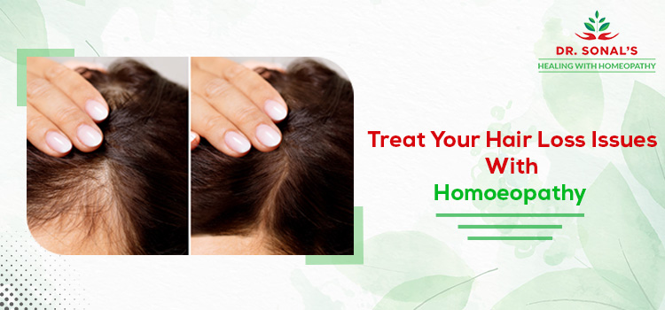 Hair Loss Issues With Homoeopathy