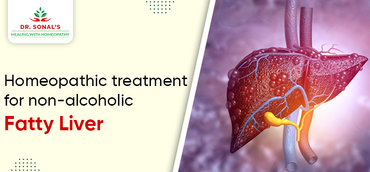 Homeopathic treatment for non-alcoholic fatty liver