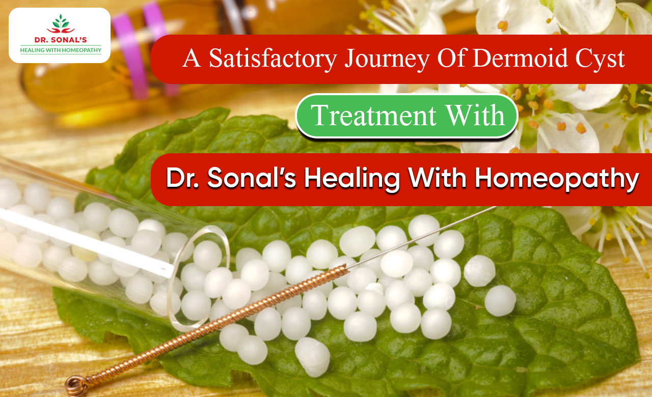 A Satisfactory Journey Of Dermoid Cyst Treatment With Dr Sonal’s Healing With Homeopathy