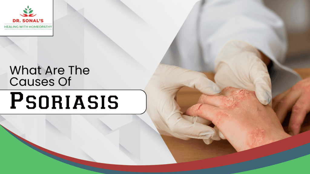 Understanding Psoriasis: Common Causes and Risk Factors